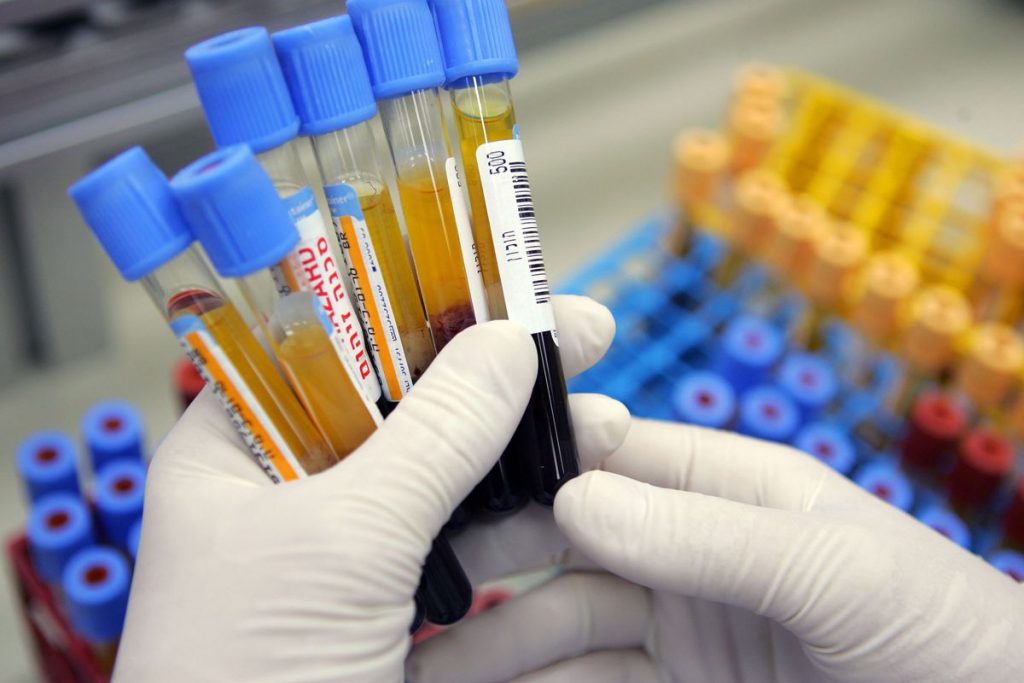 Gloved hands holding labeled blood sample tubes